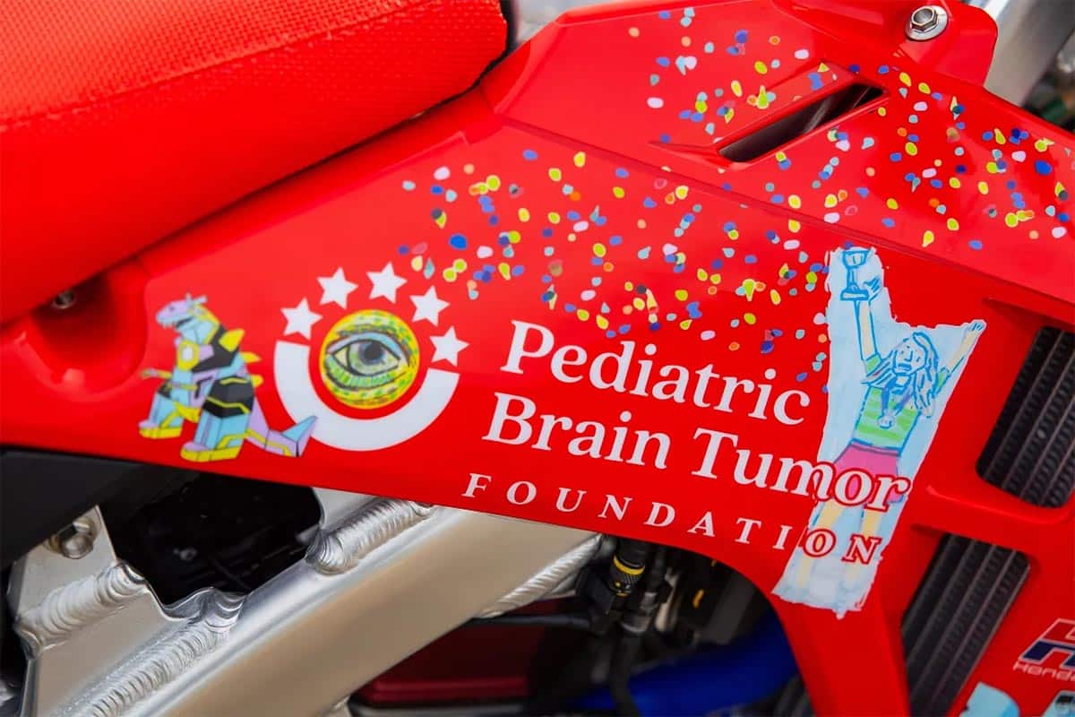 La subasta es a favor de la Pediatric Brain Tumor Foundation